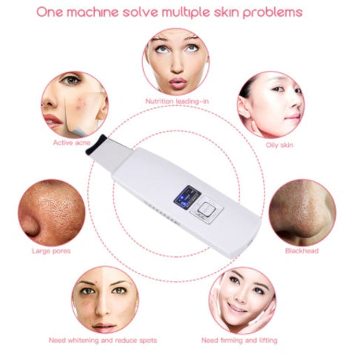 Limpiador Ultrasónico Facial — Elimina Puntos Negros y Acné al Instante