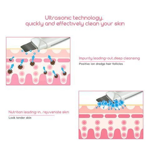 Limpiador Ultrasónico Facial — Elimina Puntos Negros y Acné al Instante
